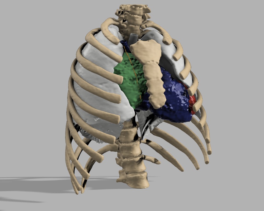 Biomodelo 3D